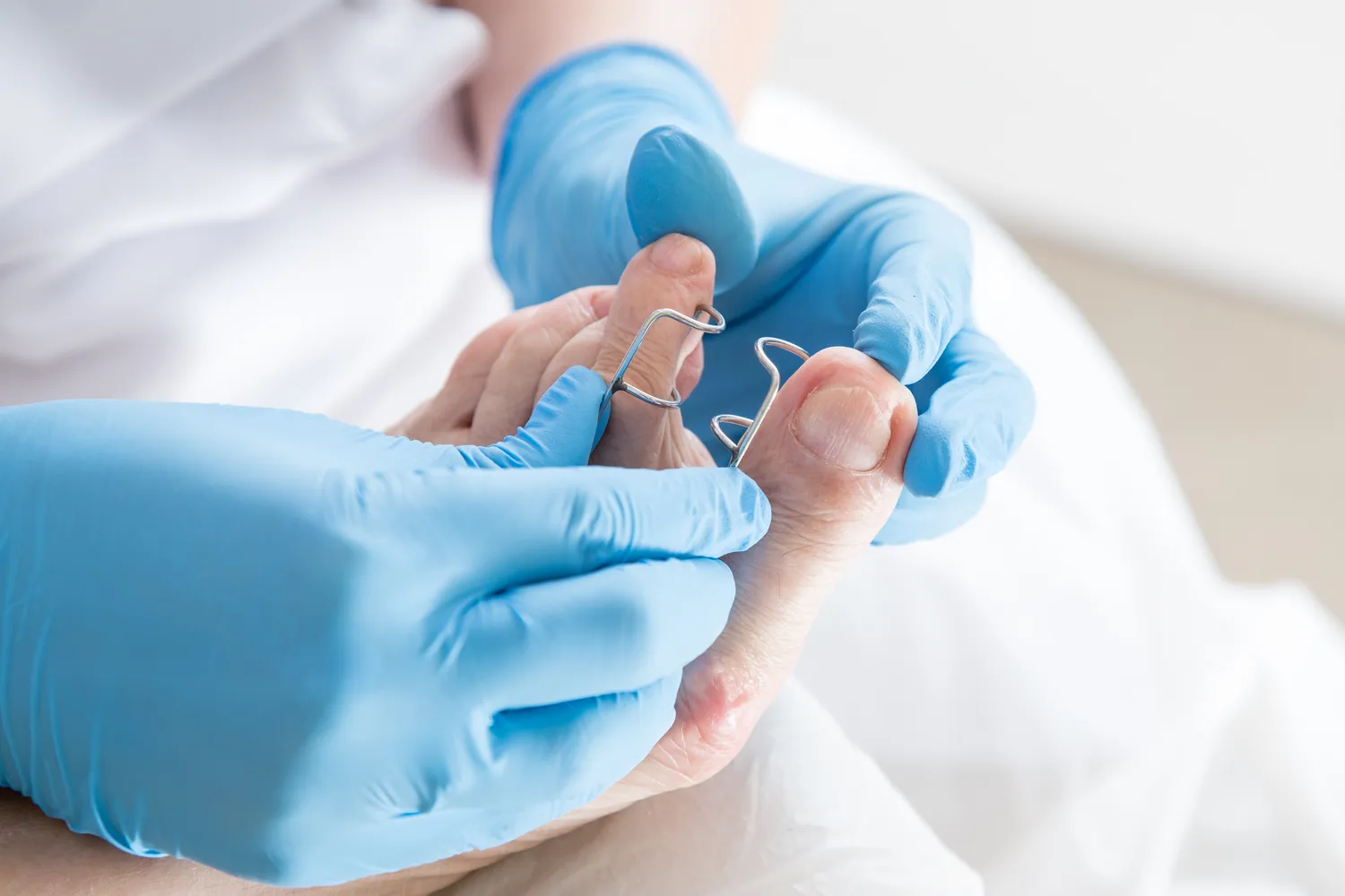 Podologia - zdrowe stopy